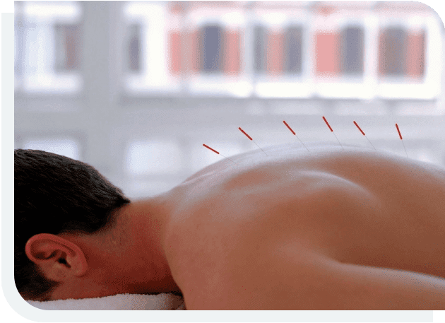 A man laying down on his back with acupuncture points.