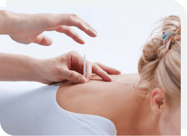 A woman getting an acupuncture needle placed on her back.